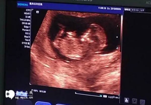 上海三代试管助孕：想了解宫腔镜手术？看看这些检查流程和详细步骤